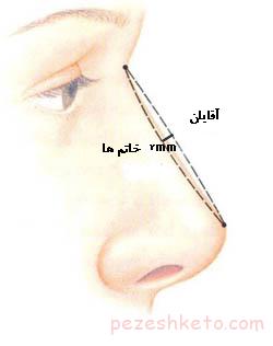 خصوصیات بینی زیبا