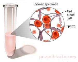 علل وجود خون در منی