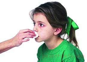 علل خون دماغ شدن کودک