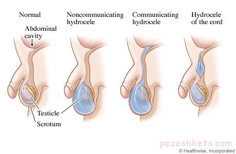 علل درد بیضه چیست