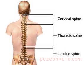 علل درد در ستون فقرات