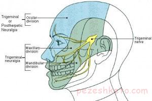 درد عصب سه قلو