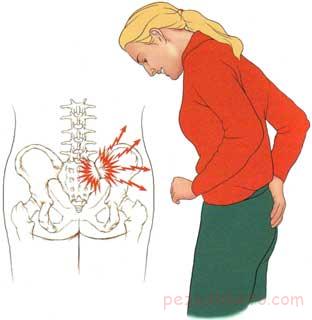 دردهای ناحیه لگن در خانمها