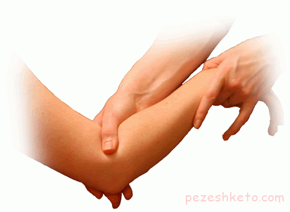 درد پشت آرنج