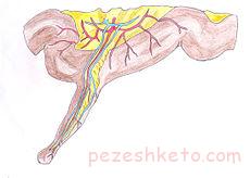 ديورتيکول مکل