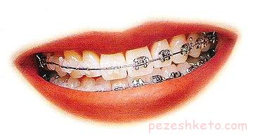 تغییر رنگ دندان نشانه چیست