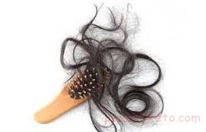 علت ریزش مو در رژیمهای لاغری