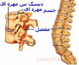 مشکلات رایج ستون فقرات