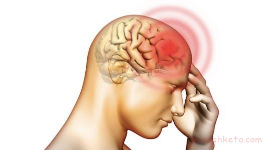 سردرد در کودکان