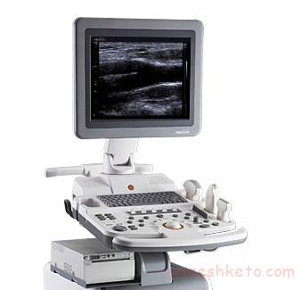 سوالات رایج درباره سونوگرافی