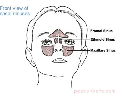 تفاوتهای سینوزیت و سرماخوردگی