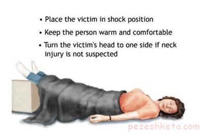 علل و انواع شوک