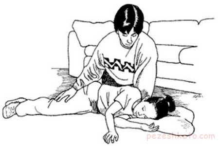 صرع پایدار چیست