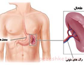 طحال و وظایف طحال