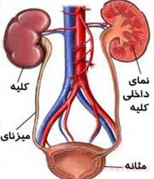 عفونت مجاری ادراری