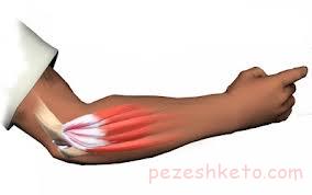 علت خشکی در مفصل آرنج