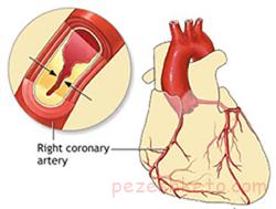 علت گرفتگی سرخ رگ ها