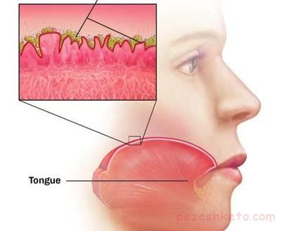 علل تلخی دهان