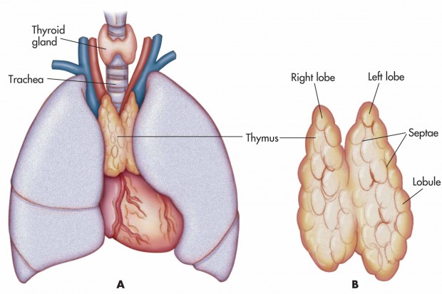 سرطان تیموس