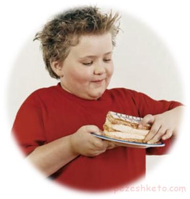 عوارض چاقی در کودکان