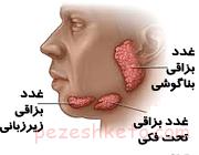 ی غدد بزاقی