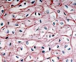 غضروف ارتجاعی