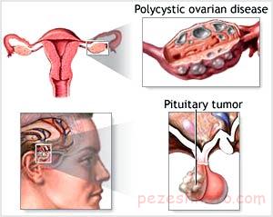 غذاهای ممنوعه در دوران قاعدگی