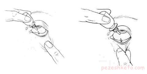 راههای استفاده از قطره چشم