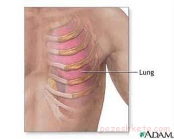 كوستوكندريت چيست