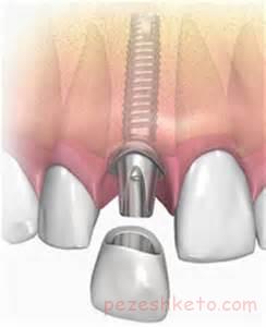 لامینیت چیست