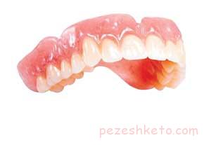 چیزهایی که لثه را تهدید می کند