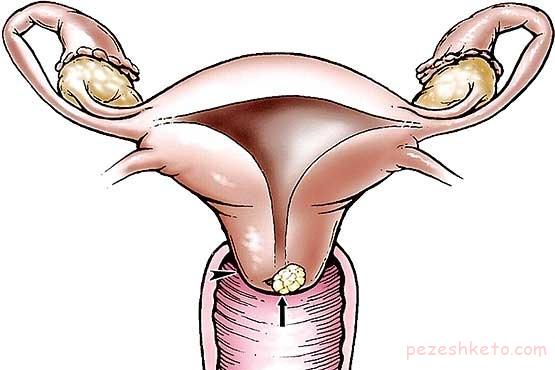 لکه بینی بین قاعدگی