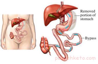 وجود خون در مدفوع نشانه چیست