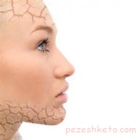 مراقبت از پوست