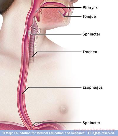 علائم بیماری مری