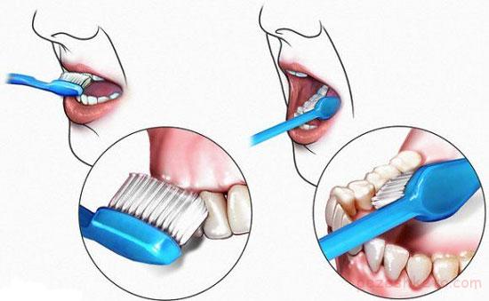 مسواک مناسب