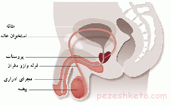 بیماریهای پروستات کدامند