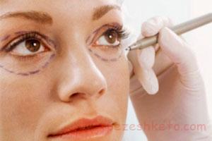 نکاتی درباره پف زیر چشم