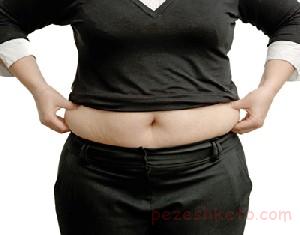 از بین بردن چربی شکم بعد از زایمان