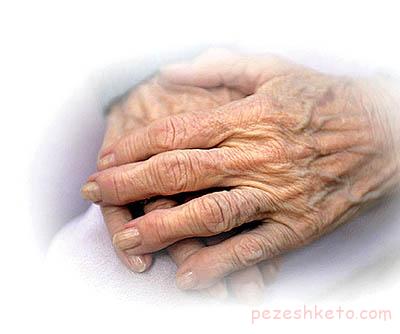 مقاله درباره چروک پوست