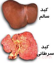 سرطان کبد چیست