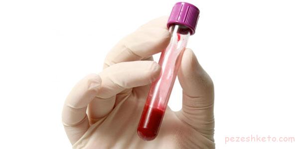 کم خونی همولیتیک چیست