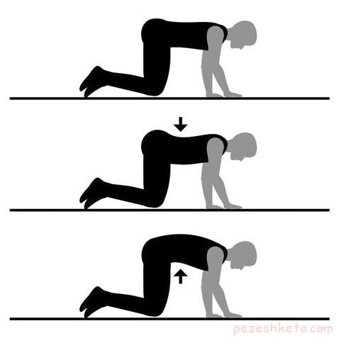 راهکارهای پیشگیری از کمر درد