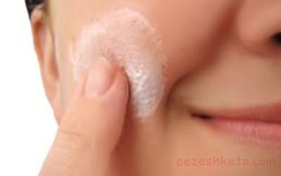 کچلی پوست چیست