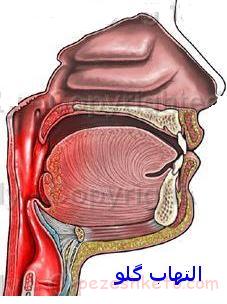مقاله درباره گلو درد کودکان